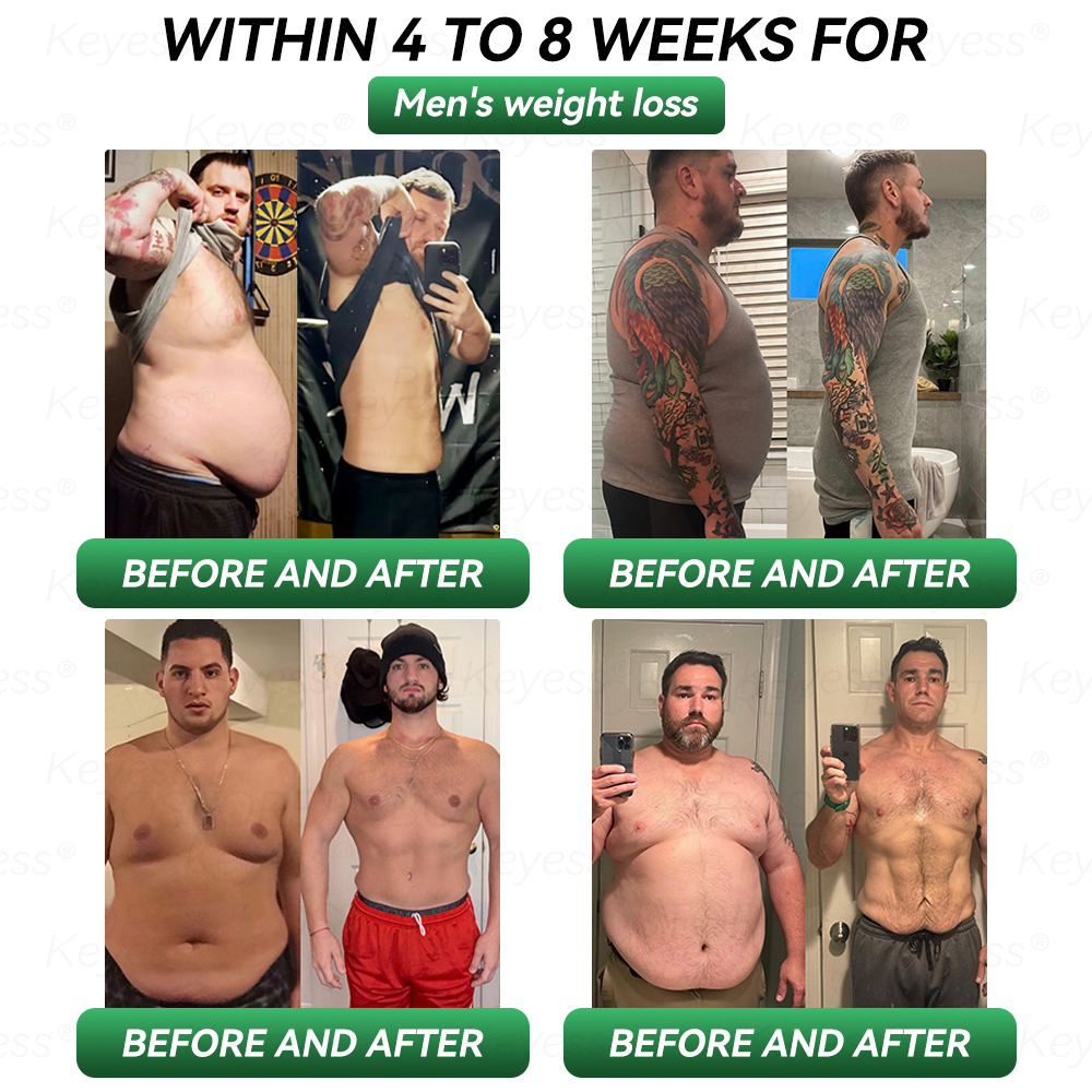 Official Store| ๐๐๐ฒ๐๐๐ยฎ๐ฅ๐ฅ GLP-1 & MatrixyI 3000 SIimming & HealIth Dropsโ
Just one dose a day โ visible results in just 7 days๐ฟFor obesity, cardiovascular health, diabetes, sleep apnea, joint issues, and more ๐