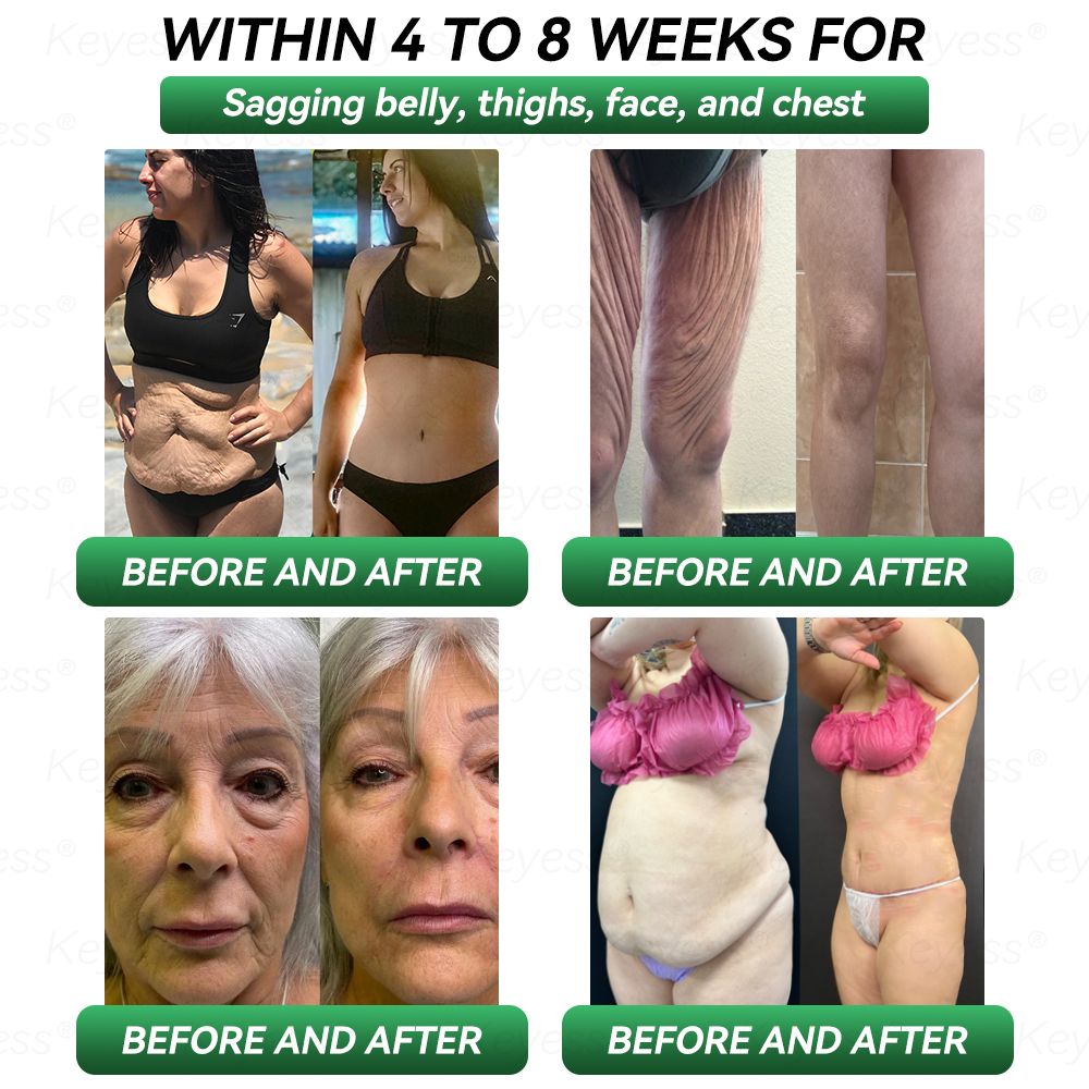 Official Store| ๐๐๐ฒ๐๐๐ยฎ๐ฅ๐ฅ GLP-1 & MatrixyI 3000 SIimming & HealIth Dropsโ
Just one dose a day โ visible results in just 7 days๐ฟFor obesity, cardiovascular health, diabetes, sleep apnea, joint issues, and more ๐