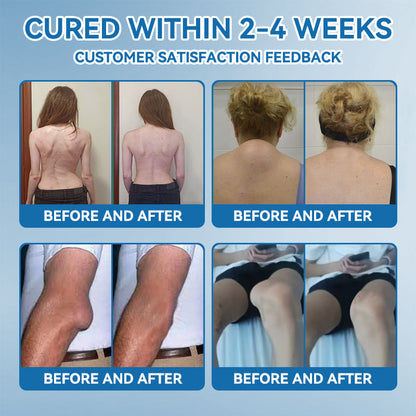 𝐎𝐟𝐟𝐢𝐜𝐢𝐚𝐥 𝐒𝐭𝐨𝐫𝐞 ✅|𝖯𝗂𝖼𝗱𝗼® BPC-157 Joint Healing Cream🦴Treats Arthritis, Neuropathy, Rheumatism, Sports Injuries & More