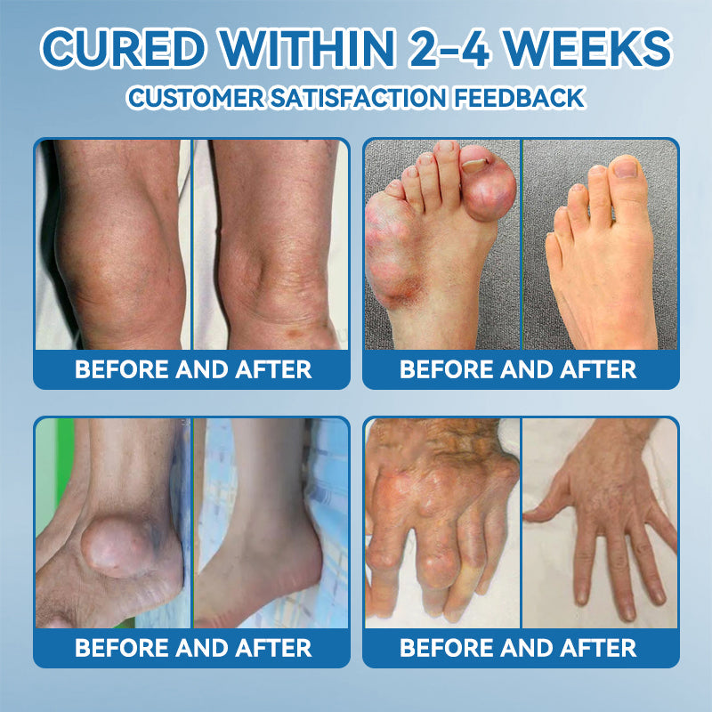 𝐎𝐟𝐟𝐢𝐜𝐢𝐚𝐥 𝐒𝐭𝐨𝐫𝐞 ✅|𝖯𝗂𝖼𝗱𝗼® BPC-157 Joint Healing Cream🦴Treats Arthritis, Neuropathy, Rheumatism, Sports Injuries & More