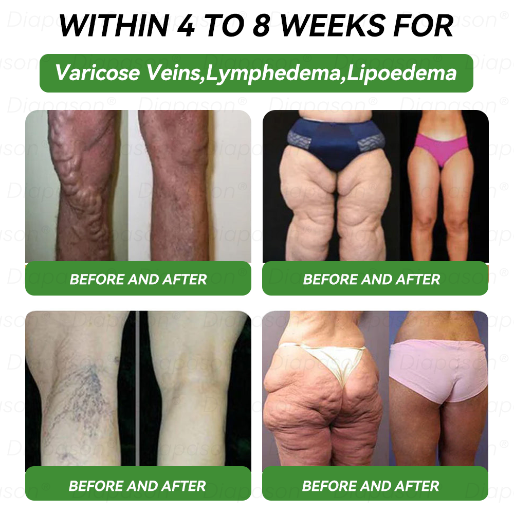 𝑶𝒇𝒇𝒊𝒄𝒊𝒂𝒍 𝑺𝒕𝒐𝒓𝒆 | 🙌𝑫𝐢𝐚𝐩𝐚𝐬𝐨𝐧®𝑮𝐋𝐏-𝟭 𝖲𝖾𝗏𝖾𝗇 𝗂𝗇 𝖮𝗇𝖾 𝖧𝖾𝖺𝗅𝗍𝗁 𝖲𝗈𝗅𝗎𝗍𝗂𝗈𝗇 𝖮𝗋𝖺𝗅 𝖫𝗂𝗊𝗎𝗂𝖽 （Suitable for obesity, cardiovascular diseases, diabetes, sleep apnea, joint issues, and more）