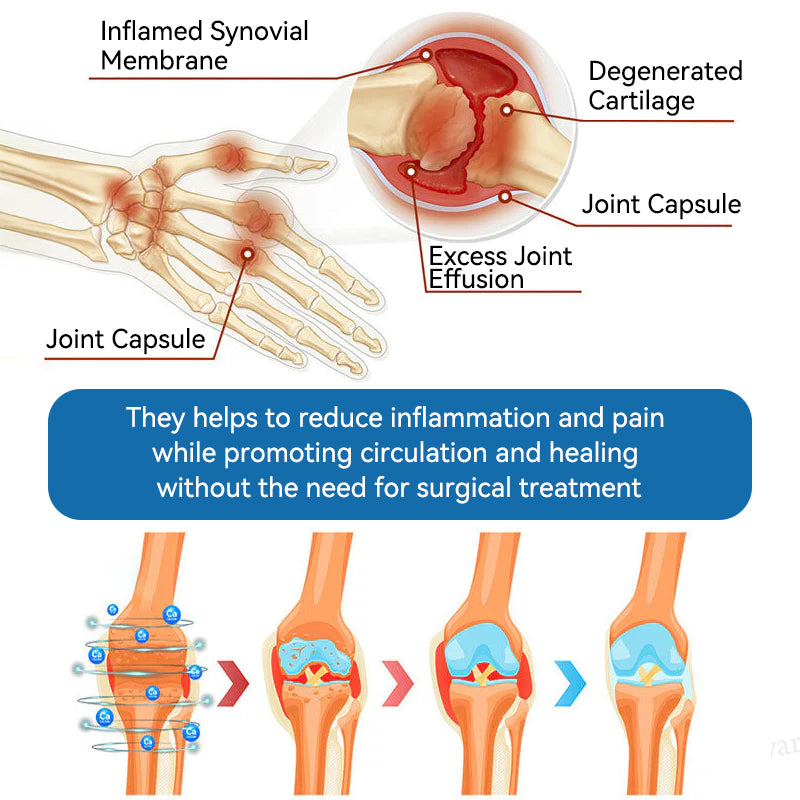 𝐎𝐟𝐟𝐢𝐜𝐢𝐚𝐥 𝐒𝐭𝐨𝐫𝐞 ✅|𝖯𝗂𝖼𝗱𝗼® BPC-157 Joint Healing Cream🦴Treats Arthritis, Neuropathy, Rheumatism, Sports Injuries & More