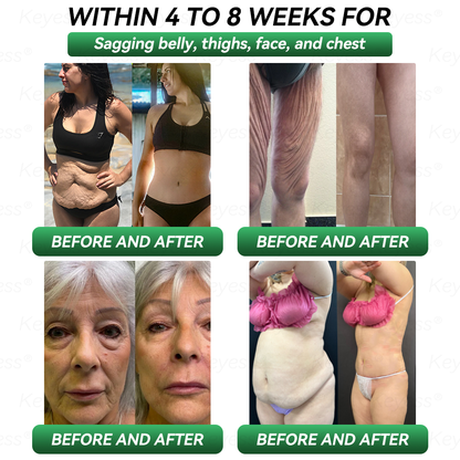 Official Store| 𝐊𝒆𝐲𝐞𝘀𝘀®🔥🔥 GLP-1 & MatrixyI 3000 SIimming & HealIth Drops✅Just one dose a day — visible results in just 7 days🌿For obesity, cardiovascular health, diabetes, sleep apnea, joint issues, and more 🏅