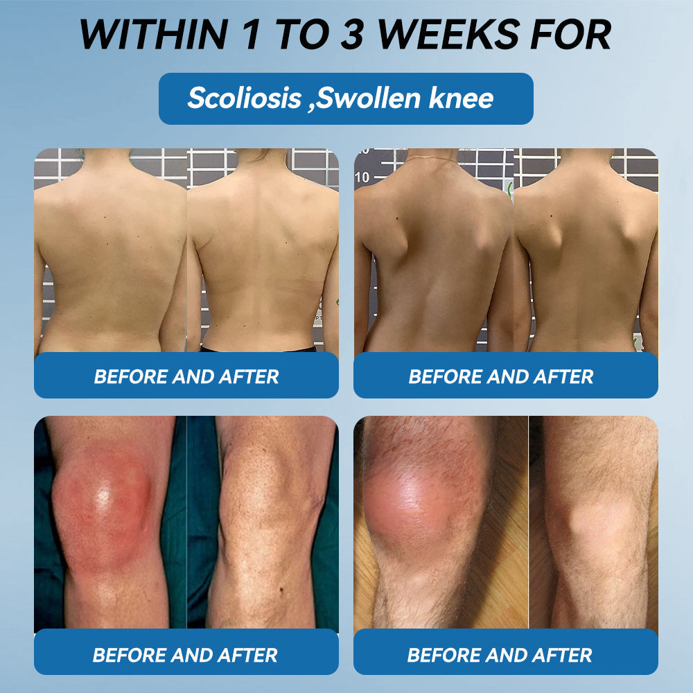 𝐎𝐟𝐟𝐢𝐜𝐢𝐚𝐥 𝐒𝐭𝐨𝐫𝐞 ✅|𝖯𝗂𝖼𝗱𝗼® BPC-157 Joint Healing Cream🦴Treats Arthritis, Neuropathy, Rheumatism, Sports Injuries & More