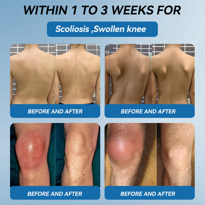 𝐎𝐟𝐟𝐢𝐜𝐢𝐚𝐥 𝐒𝐭𝐨𝐫𝐞 ✅|𝖯𝗂𝖼𝗱𝗼® BPC-157 Joint Healing Cream🦴Treats Arthritis, Neuropathy, Rheumatism, Sports Injuries & More