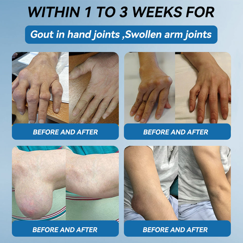 𝐎𝐟𝐟𝐢𝐜𝐢𝐚𝐥 𝐒𝐭𝐨𝐫𝐞 ✅|𝖯𝗂𝖼𝗱𝗼® BPC-157 Joint Healing Cream🦴Treats Arthritis, Neuropathy, Rheumatism, Sports Injuries & More