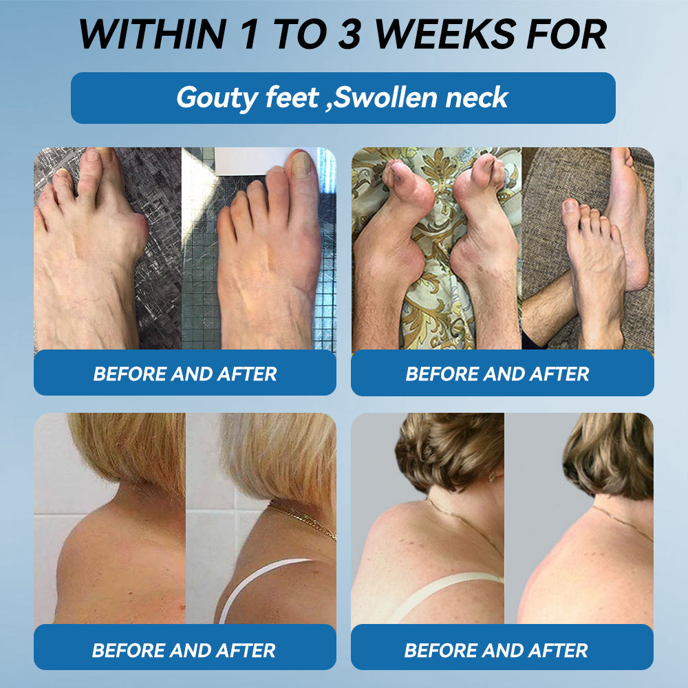𝐎𝐟𝐟𝐢𝐜𝐢𝐚𝐥 𝐒𝐭𝐨𝐫𝐞 ✅|𝖯𝗂𝖼𝗱𝗼® BPC-157 Joint Healing Cream🦴Treats Arthritis, Neuropathy, Rheumatism, Sports Injuries & More
